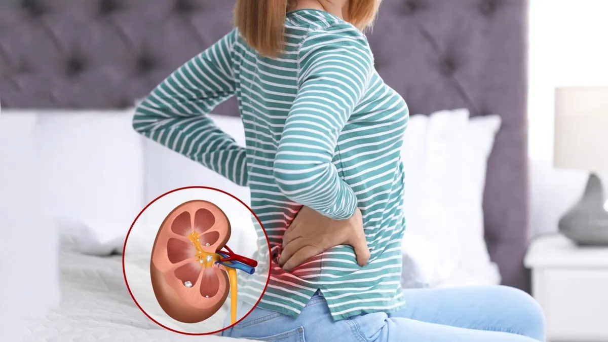 Kidney Stones: சிறுநீரக கற்களால் முதுகு வலி ஏற்படுமா? மருத்துவர் கூறுவது என்ன?