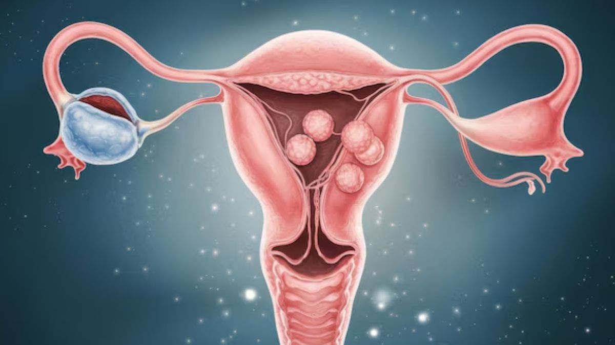 artical  - 2025-01-17T094929.952