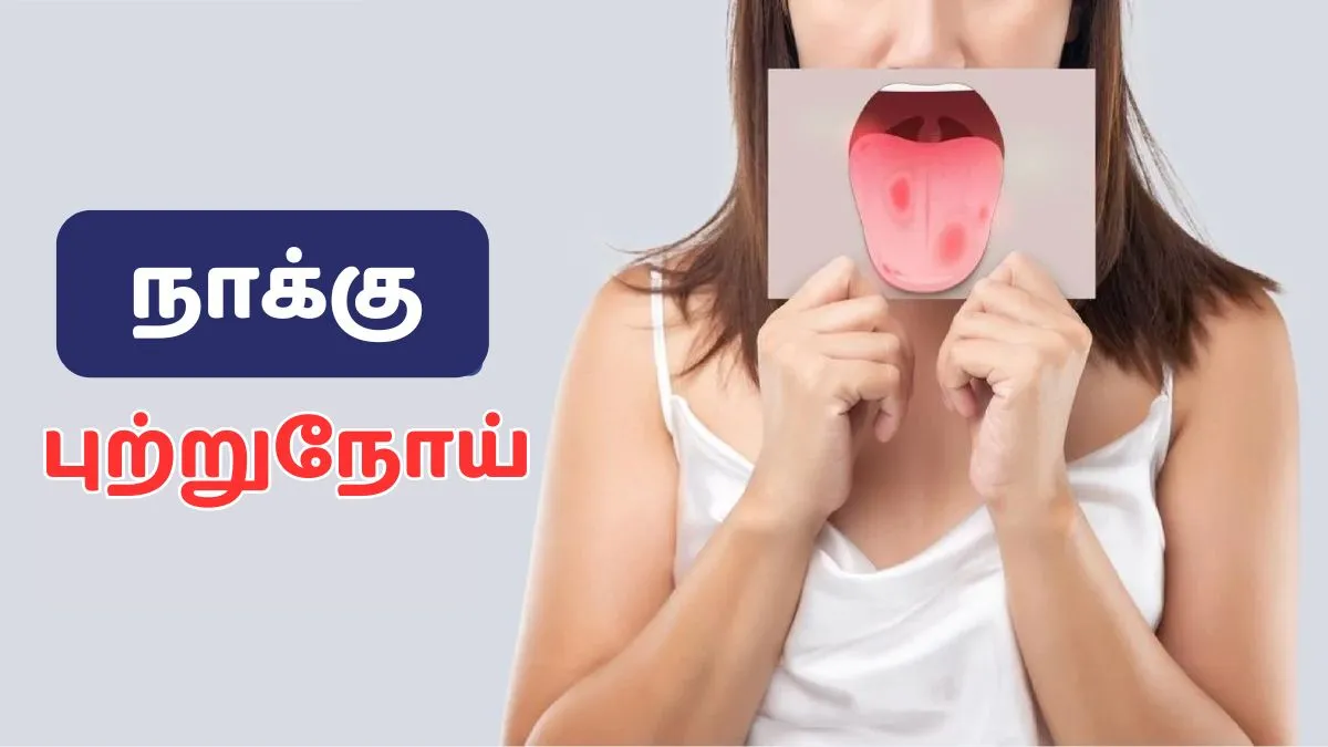 Tongue Cancer: நாக்கில் தோன்றும் இந்த அறிகுறிகளை லேசுல விடாதீங்க.. புற்றுநோயின் அறிகுறியாக இருக்கலாம்!