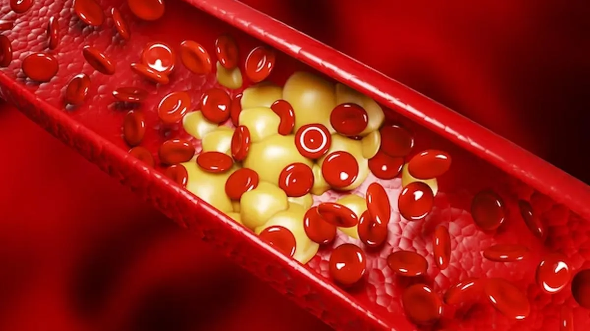 Natural Remedies For Cholesterol: கொலஸ்ட்ரால் பிரச்சனையால் அவதியா? இந்த 2 விதையை தண்ணீரில் ஊறவைத்து குடியுங்க!