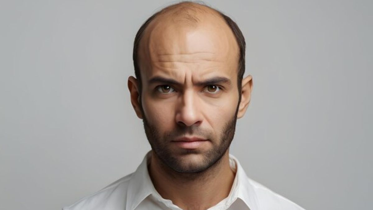 smoke-hair-loss