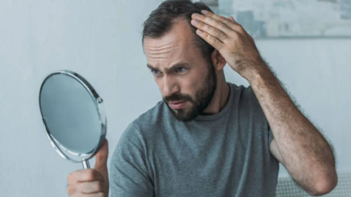 Male Baldness: ஆண்களே., வழுக்கை தொல்லை இனி இல்லை, இயற்கையான வீட்டு வைத்திய முறைகள் இதோ!