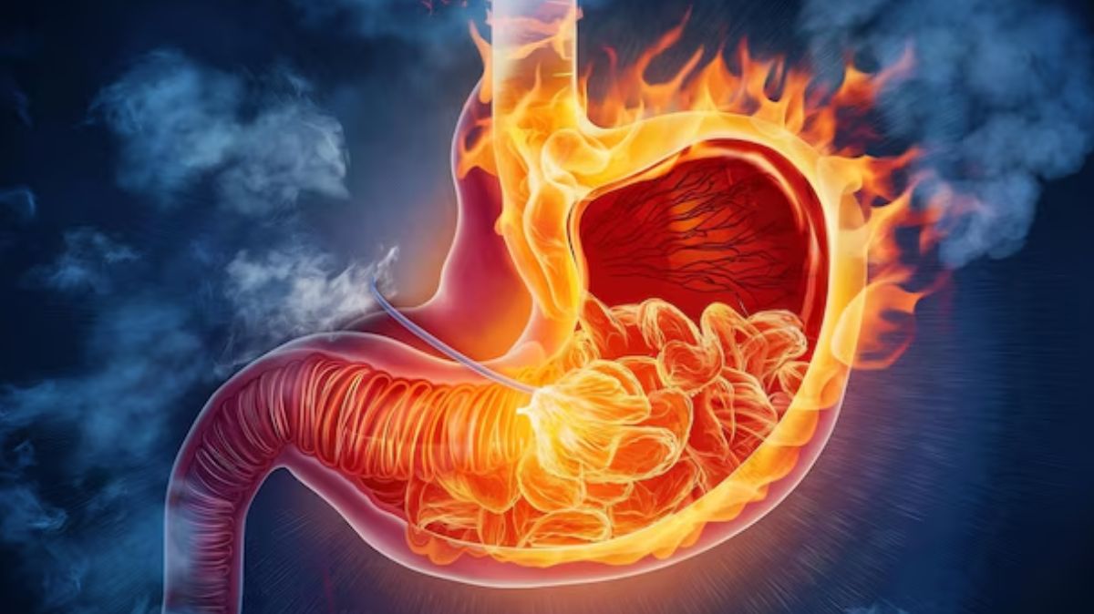 artical  - 2025-01-27T183512.431