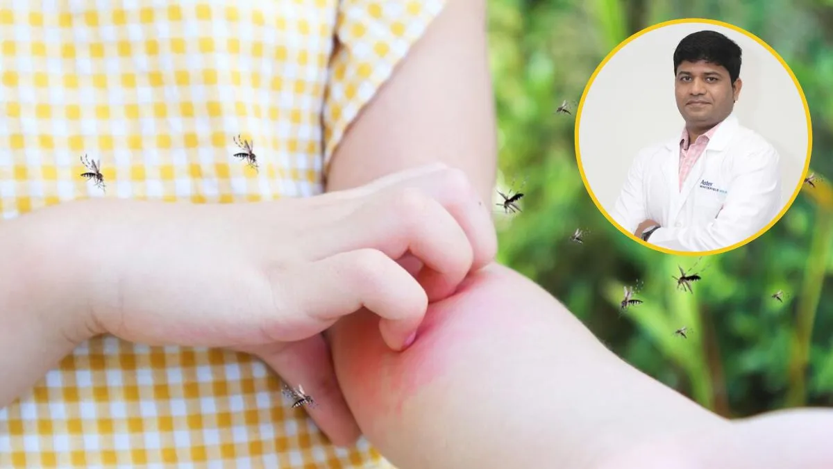 Tropical diseases: முக்கிய வெப்பமண்டல நோய்களும், அதை தடுக்கும் முறைகளும்! மருத்துவர் தரும் குறிப்புகள் இதோ