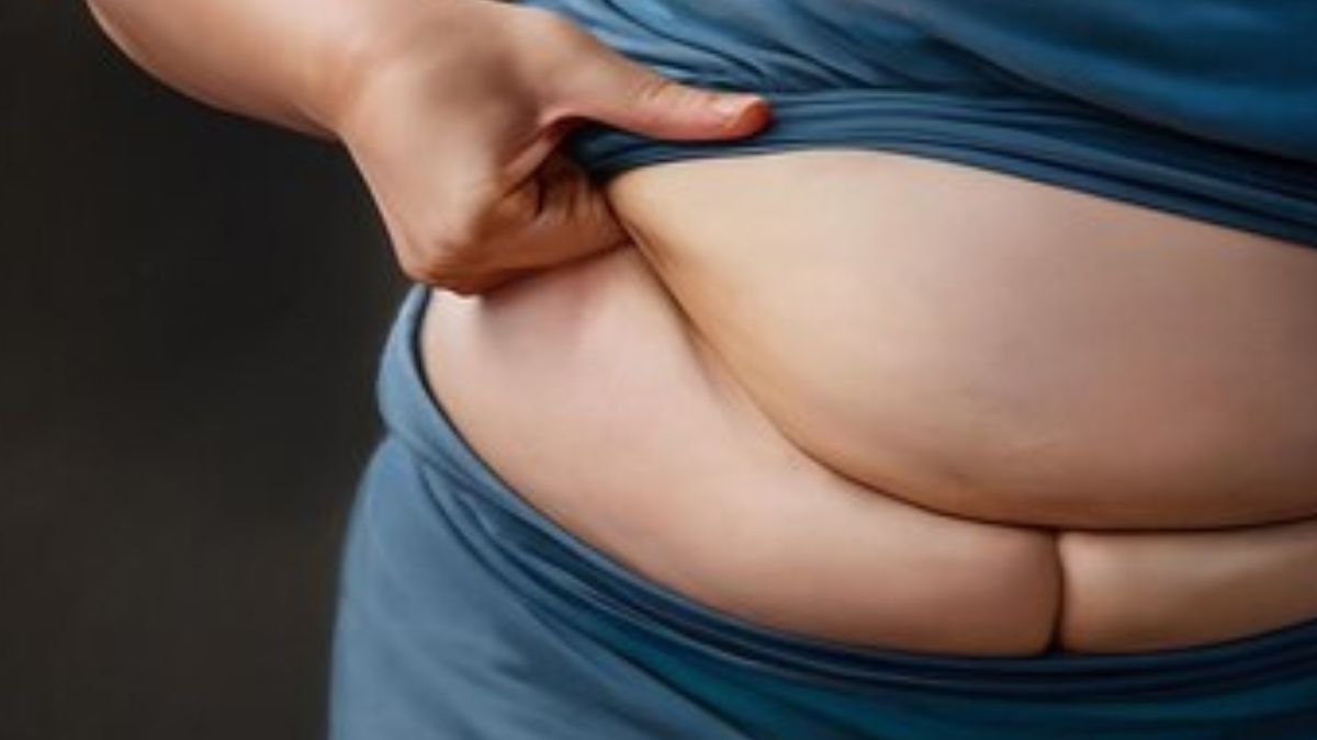 saggy stomach after weight loss