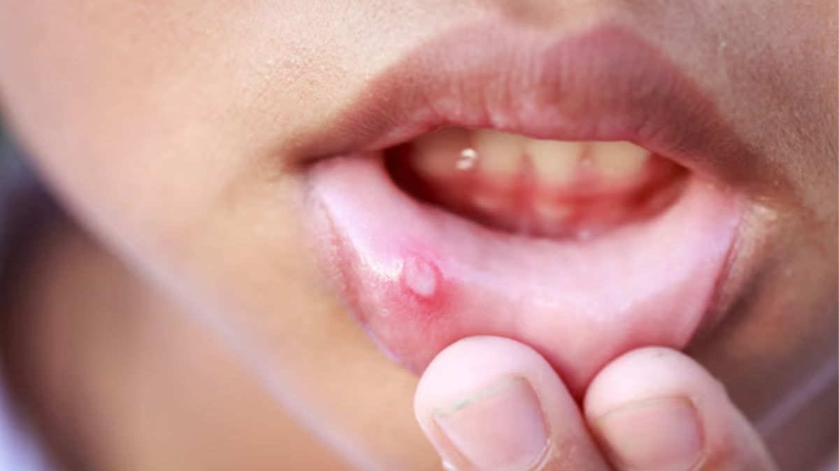 artical  - 2025-02-12T112340.244