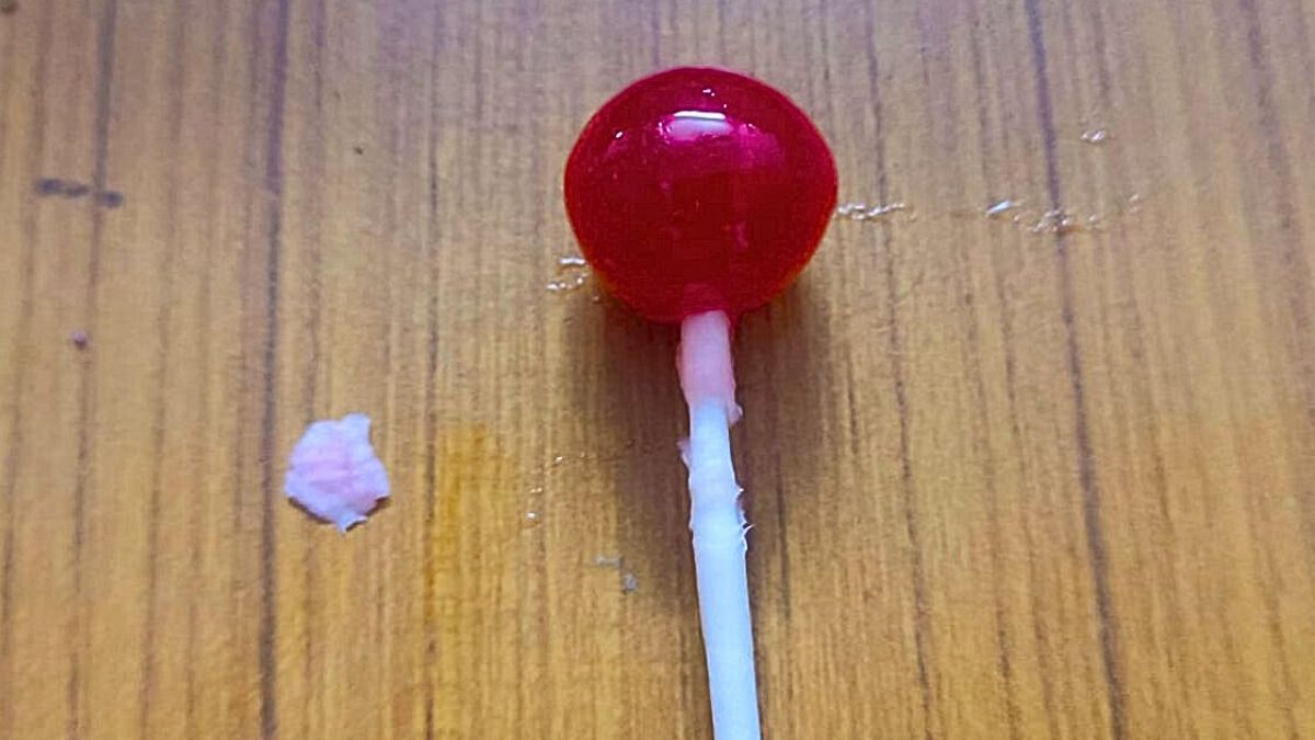 lollipop-side-effects