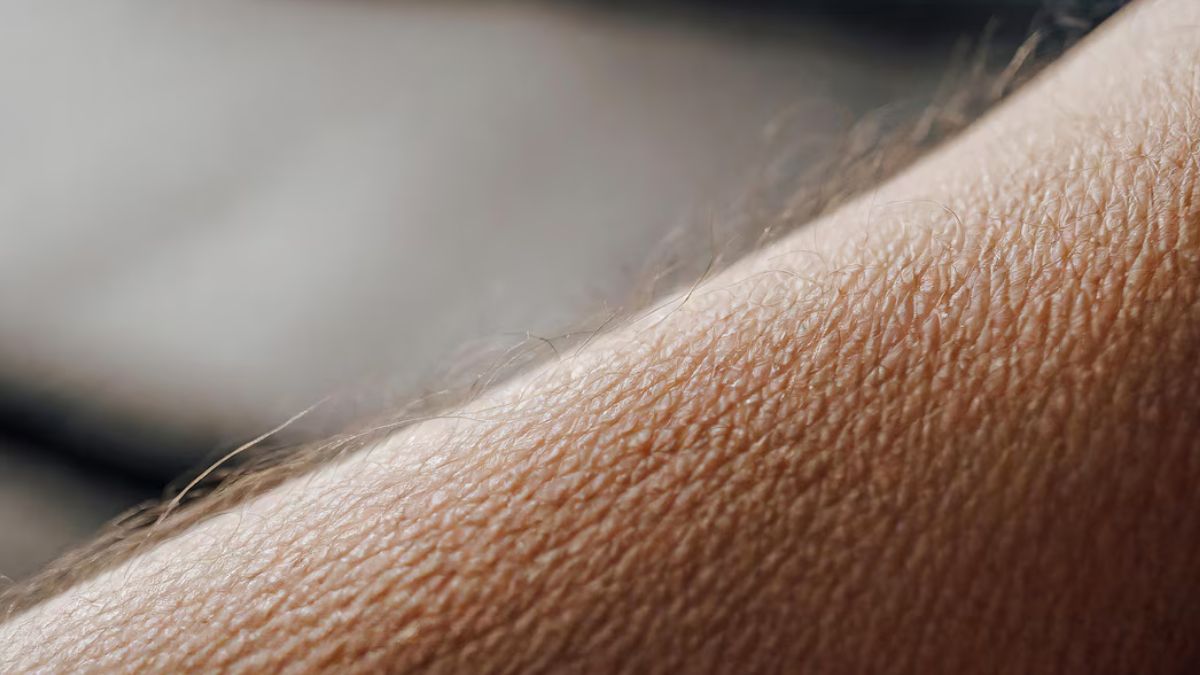 goosebumps medical reason