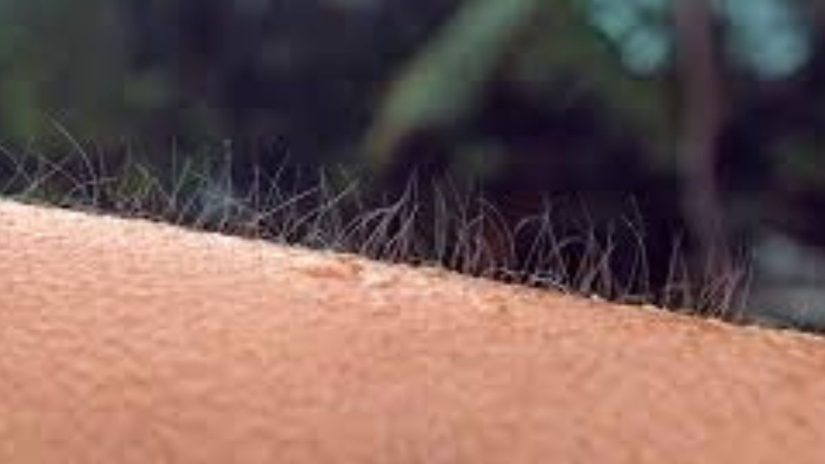why does a person get goosebumps