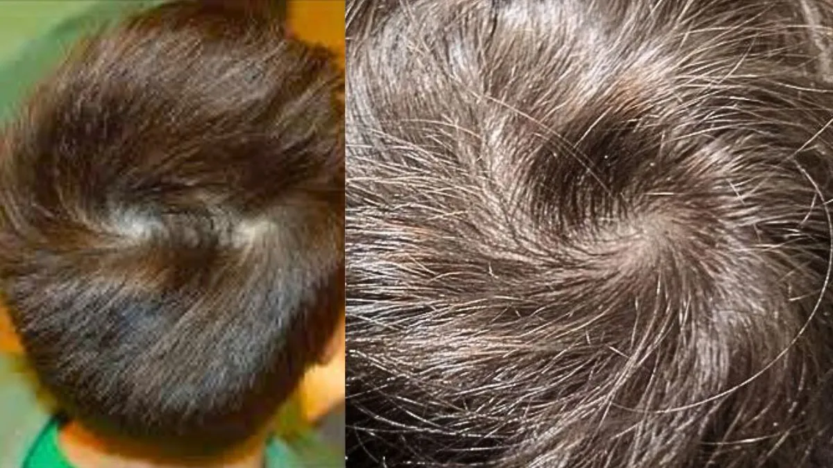 Head Whorl: தலையில் ஒற்றை சுழி, இரட்டை சுழி அர்த்தம் என்ன? எத்தனை சுழிகள் வாழ்க்கைக்கு நல்லது?