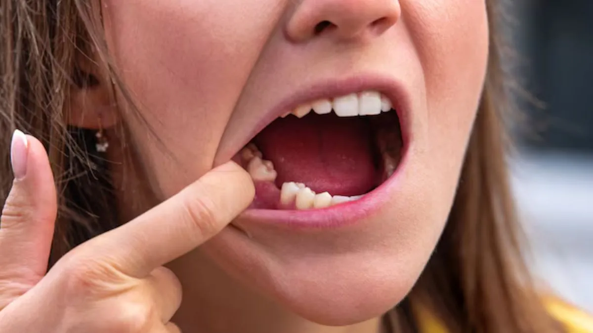 World Oral Health Day 2025: வாயில் துர்நாற்றம் வீசுவதற்கு ஈறு பிரச்சனை காரணமா? துர்நாற்றம் போக்க வீட்டு வைத்தியம்!
