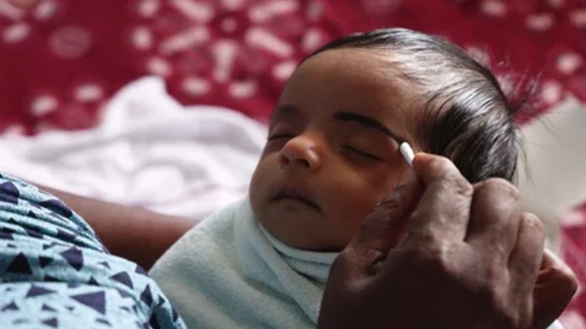 குழந்தைக்கு கண்ணு படக்கூடாதுனு திருஷ்டி பொட்டு வைக்கிறீங்களா.? ஆனால் அது எவ்வளவு ஆபத்து தெரியுமா.?