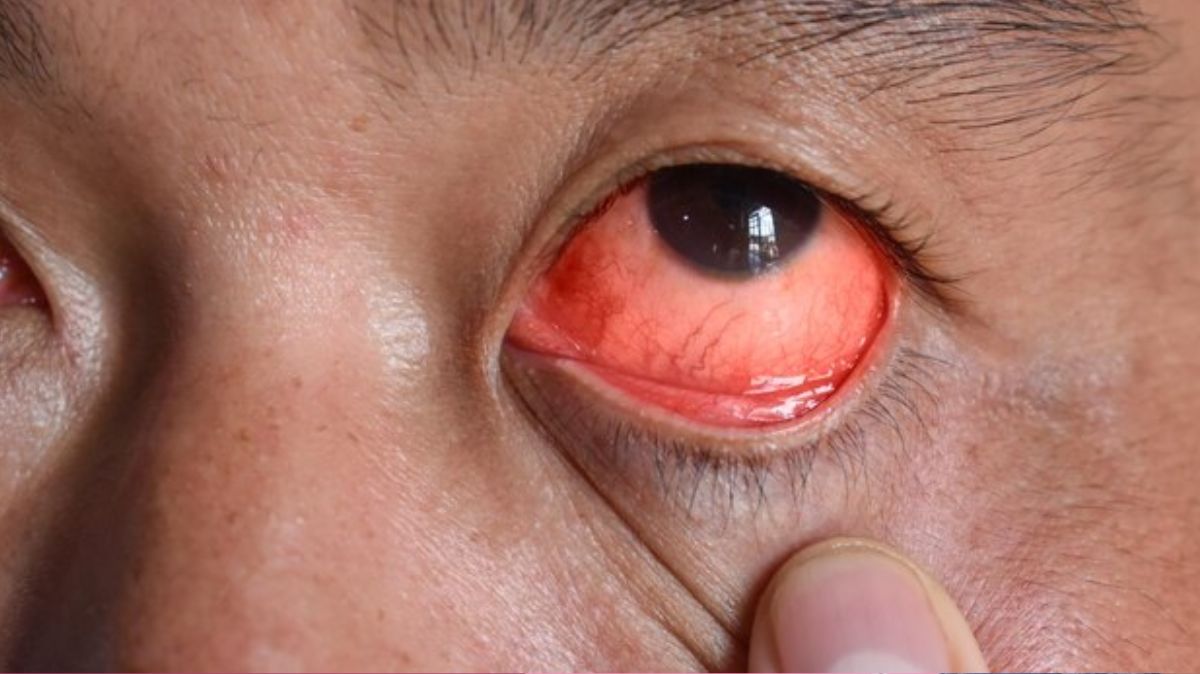 artical  - 2025-04-02T102921.400