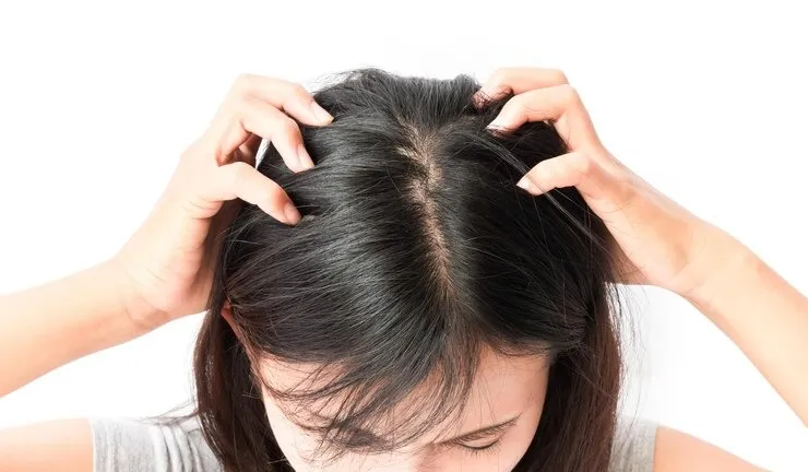 Scalp care in summer: கோடை வெயிலில் இருந்து உச்சந்தலையை பாதுகாக்க, இந்த 5 விஷயங்கள பாலோப் பண்ணுங்க!