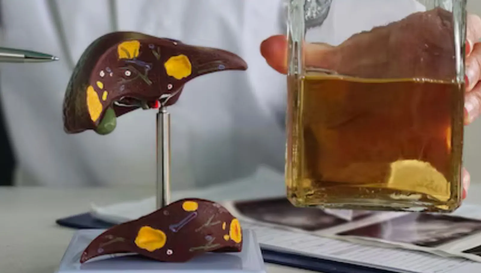 Liver Disease Symptoms: கல்லீரல் புற்றுநோயின் ஆரம்ப அறிகுறிகள் இதெல்லாம் தான்., கவனமா இருங்க!