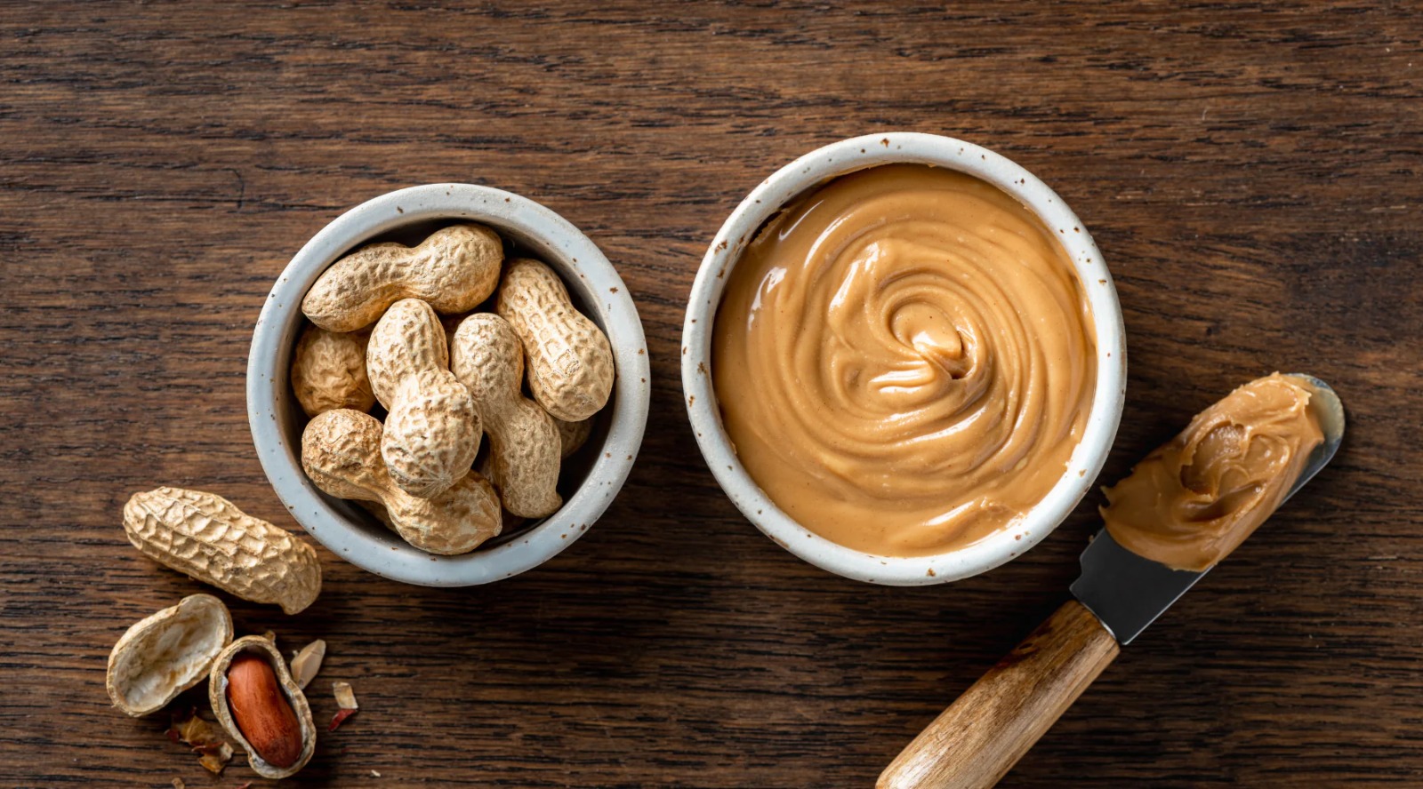 Peanut Butter: ஆசிட் ரிஃப்ளக்ஸ் நோயாளிகள் பீனட் பட்டர் சாப்பிடலாமா? நிபுணர்கள் கூறுவது இங்கே!