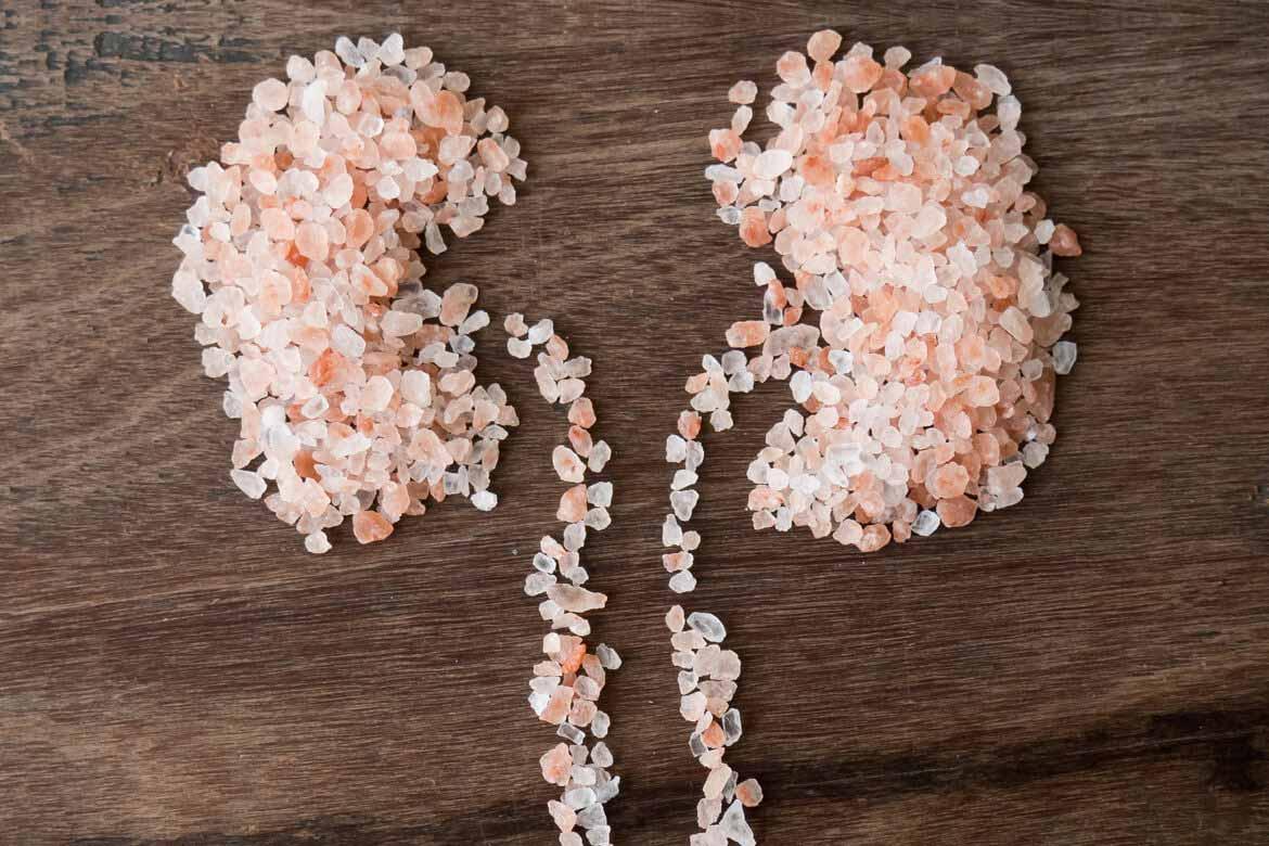Kidney Stones: அதிக உப்பு சாப்பிட்டால் சிறுநீரக கல் பிரச்சனை வருமா? இதோ உங்களுக்கான பதில்!!