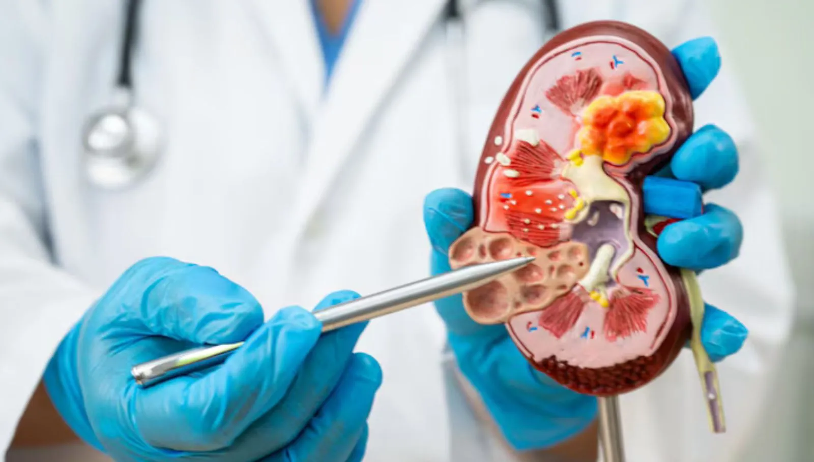 Kidney Stone: சிறுநீரக கற்கள் ஏற்படும் அபாயத்தை அதிகரிக்கும் உணவுகள்!