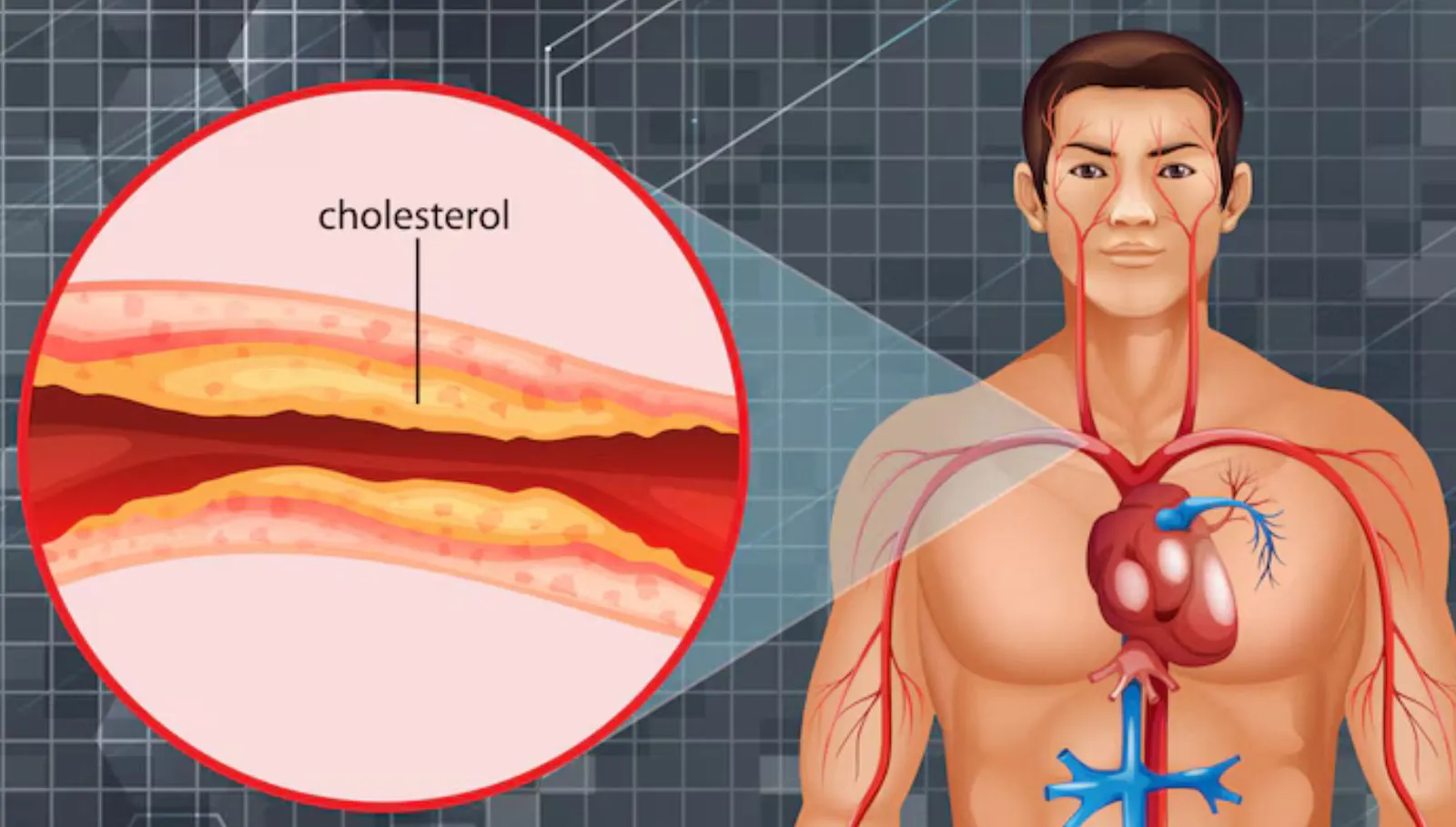 High Cholesterol Signs: அதிக கொழுப்பின் 8 எச்சரிக்கை அறிகுறிகள் இதுதான்!