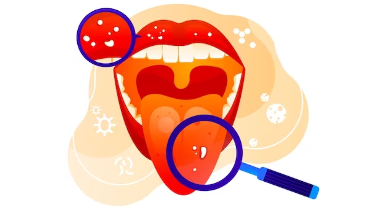 what-are-the-symptoms-of-mouth-cancer-main
