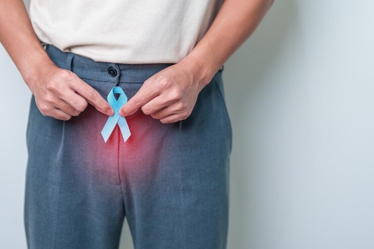 blue-november-prostate-cancer-aw