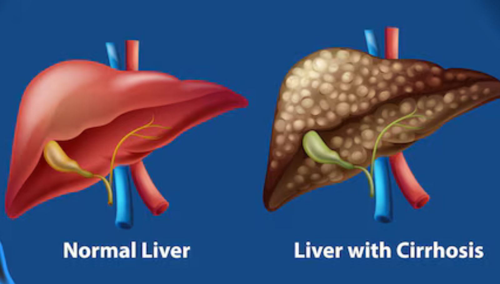 liver-detox-foods