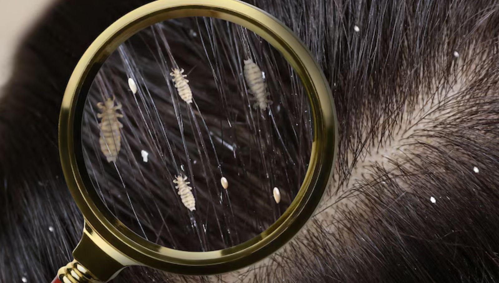 head-lice-home-remedy