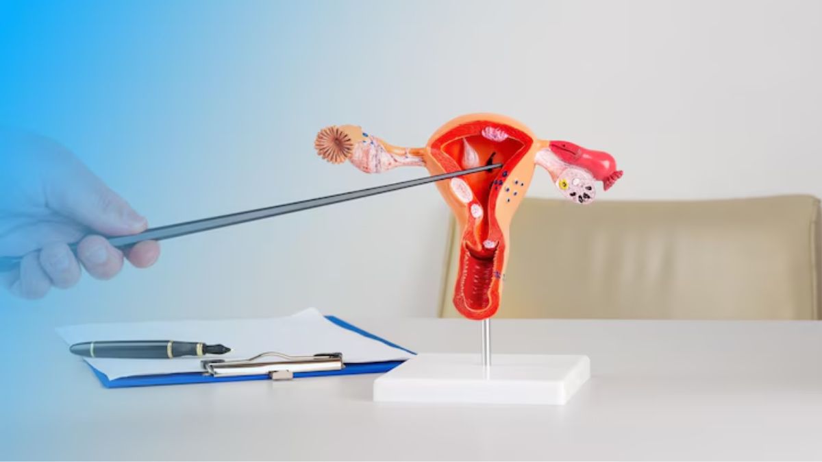 artical - 2025-06-20T103830.250