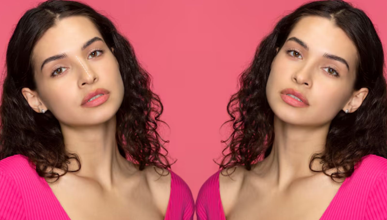 swollen-face-before-after