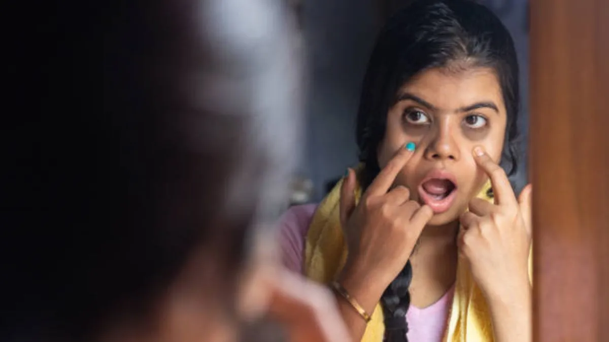 போமாட்டேன்னு பிடிவாதம் பண்ணும் கருவளையங்கள்.. அடிச்சி விரட்டும் ரெமிடிஸ் இங்கே..
