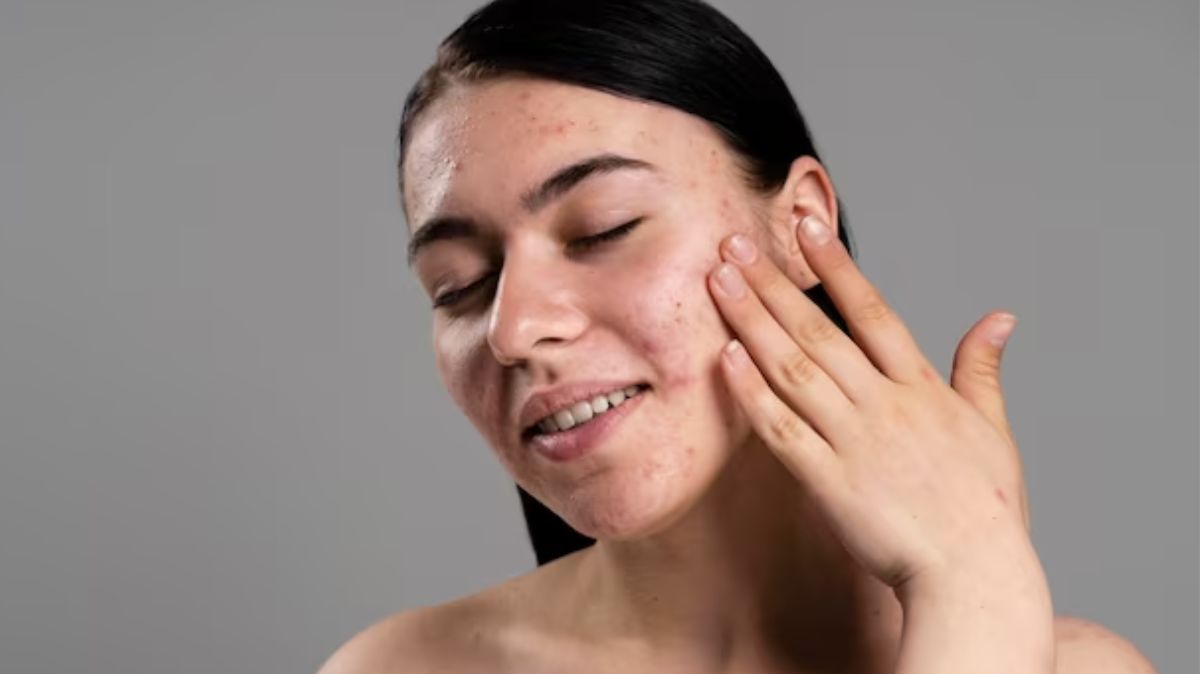 how to get rid of dry skin