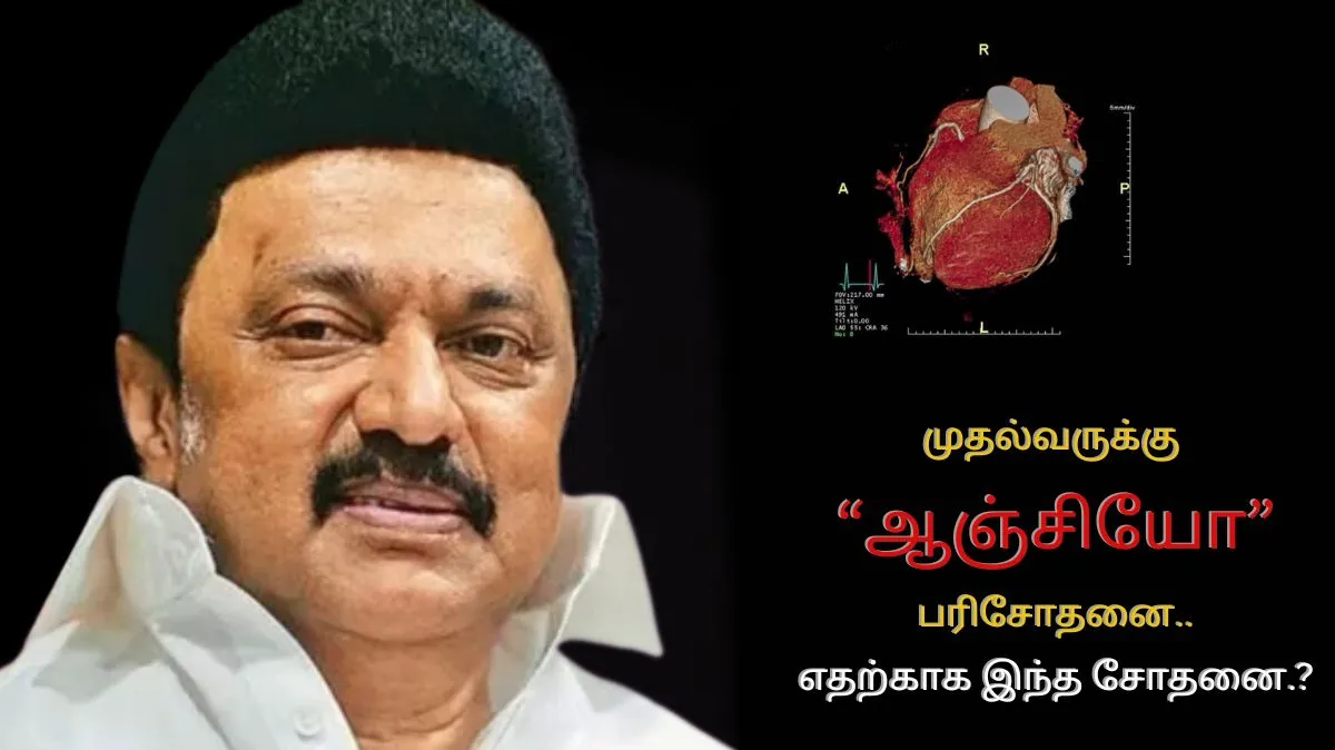 முதல்வர் ஸ்டாலினுக்கு ஆஞ்சியோ பரிசோதனை.! ஆஞ்சியோகிராபி பரிசோதனை எதற்காக எடுக்கப்படுகிறது தெரியுமா.? விளக்கம் இங்கே..