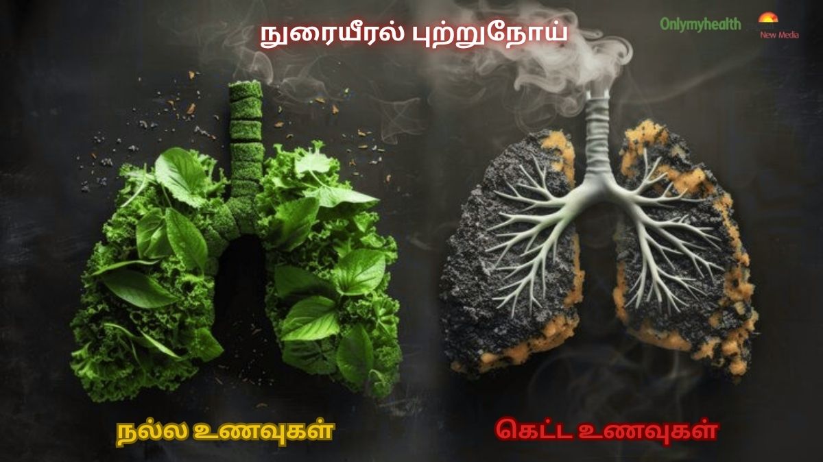 தவறான உணவு.. பேராபத்து.! Lung Cancer கட்டுக்குள் இருக்க.. இதை சாப்பிடவும்..