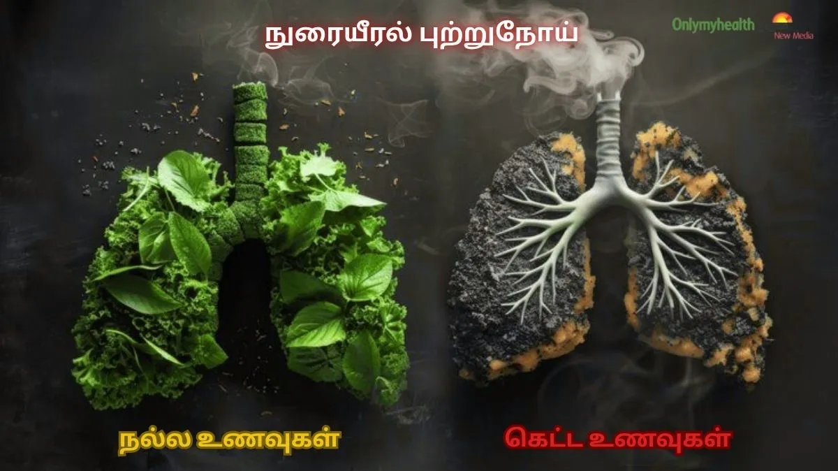 தவறான உணவு.. பேராபத்து.! Lung Cancer கட்டுக்குள் இருக்க.. இதை சாப்பிடவும்..