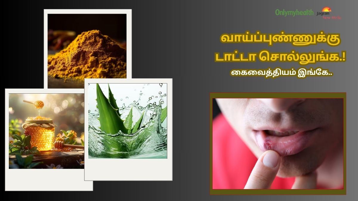 வாய்ப்புண் குறைய சூப்பர் கைவைத்தியம் இங்கே.!