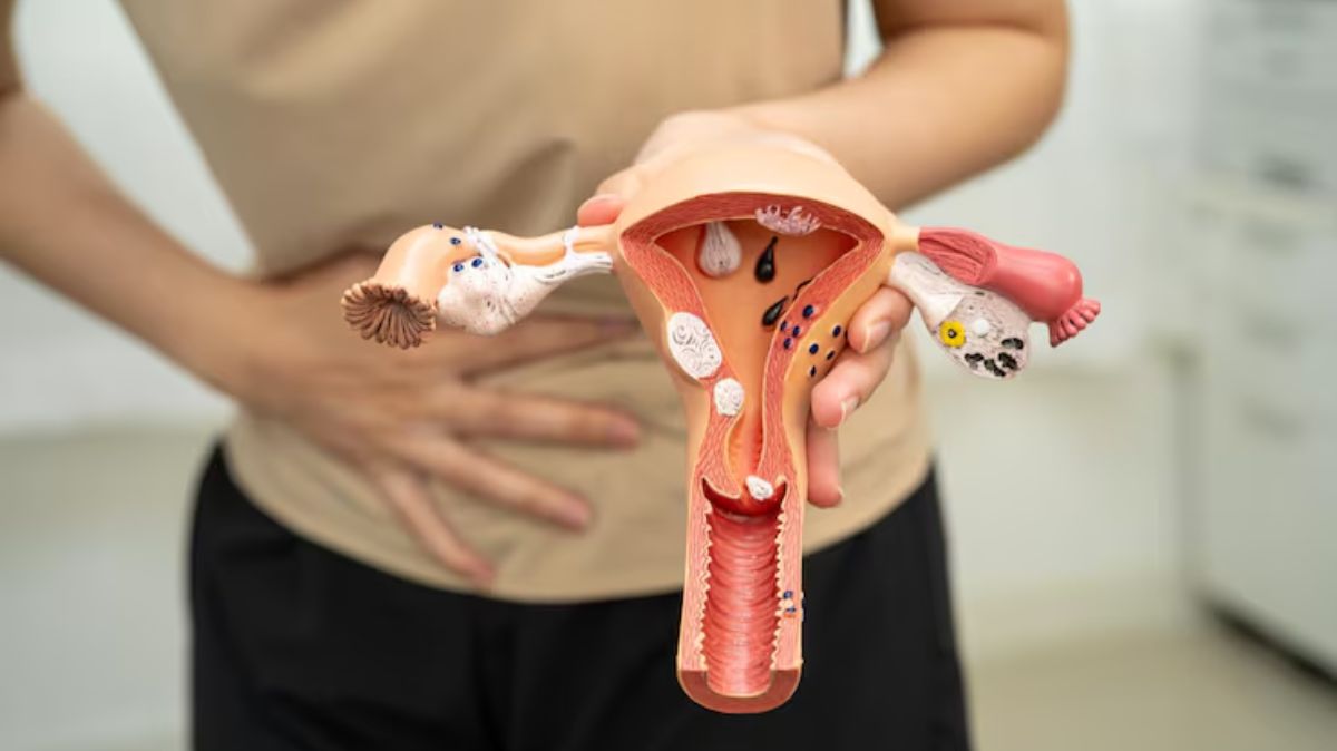 artical - 2025-08-01T170214.431