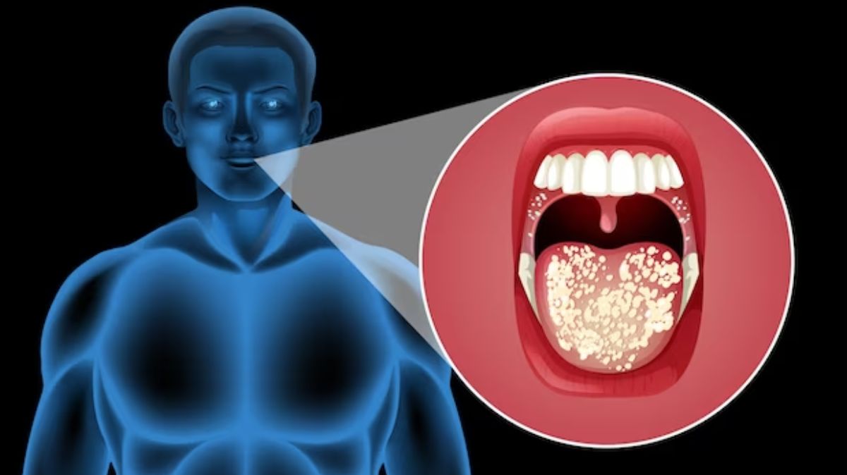 symptoms of mouth cancer