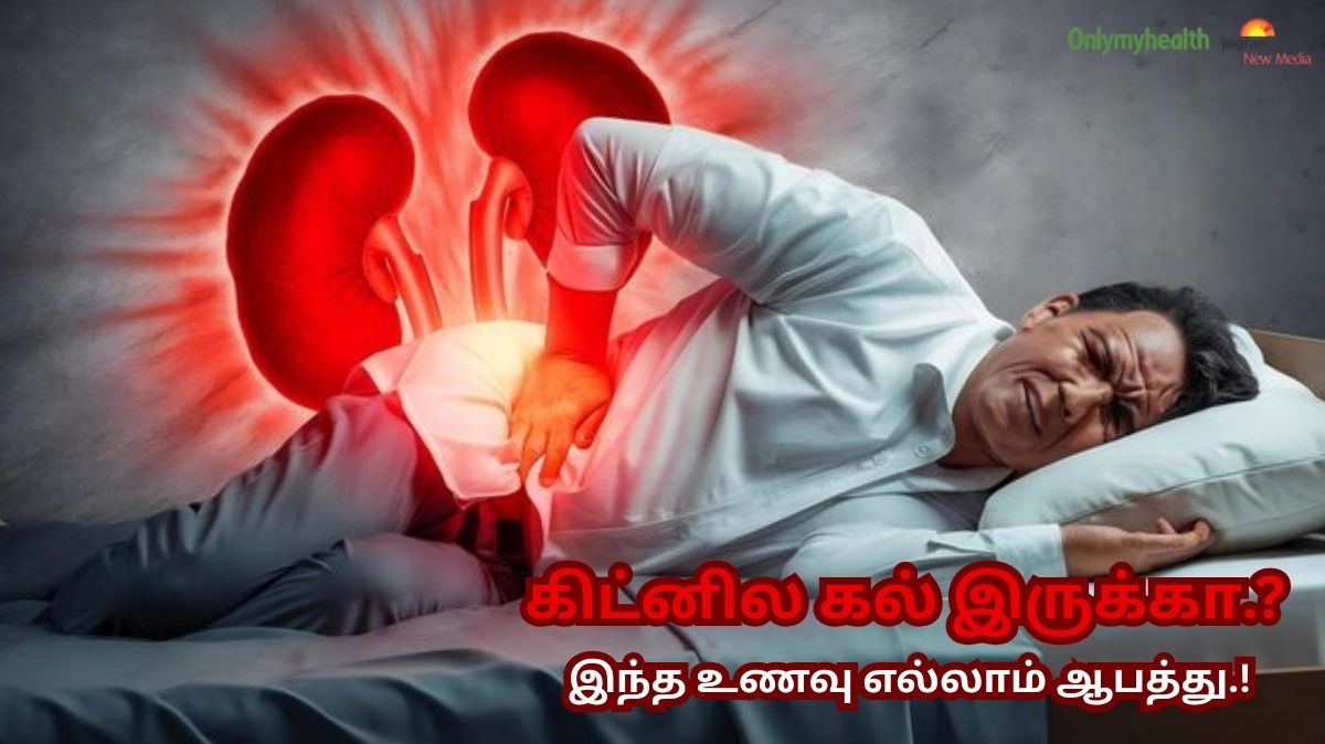 Kidney Stone patients கவனிக்கவும்.. இந்த உணவு உங்களுக்கு விஷம் போல வேலை செய்யும் Silent Killer.!
