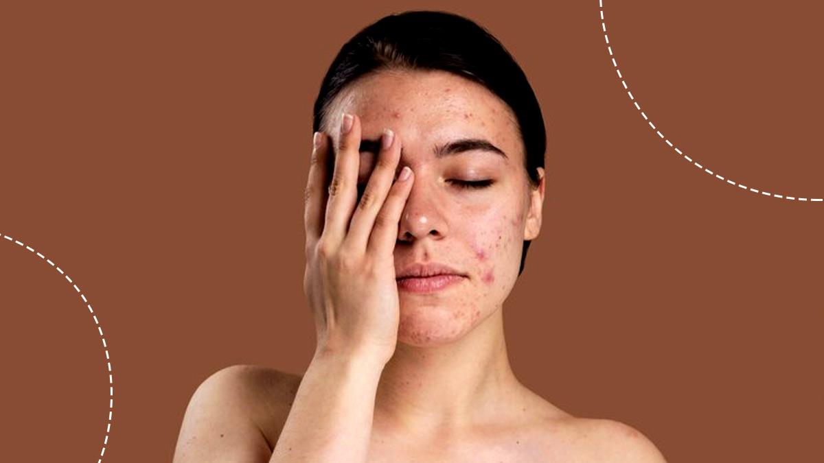 what-can-cause-red-spot-to-appear-on-the-skin-main