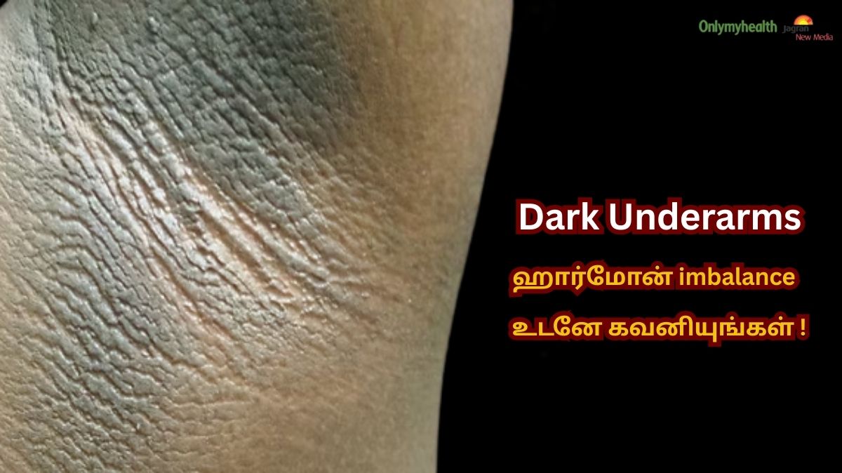 Dark Underarms.. வெறும் அழகு பிரச்சினை அல்ல.. உங்கள் உடல் அனுப்பும் Signal.! உடனே தெரிஞ்சிக்கோங்க..