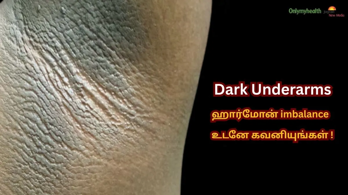 Dark Underarms.. வெறும் அழகு பிரச்சினை அல்ல.. உங்கள் உடல் அனுப்பும் Signal.! உடனே தெரிஞ்சிக்கோங்க..