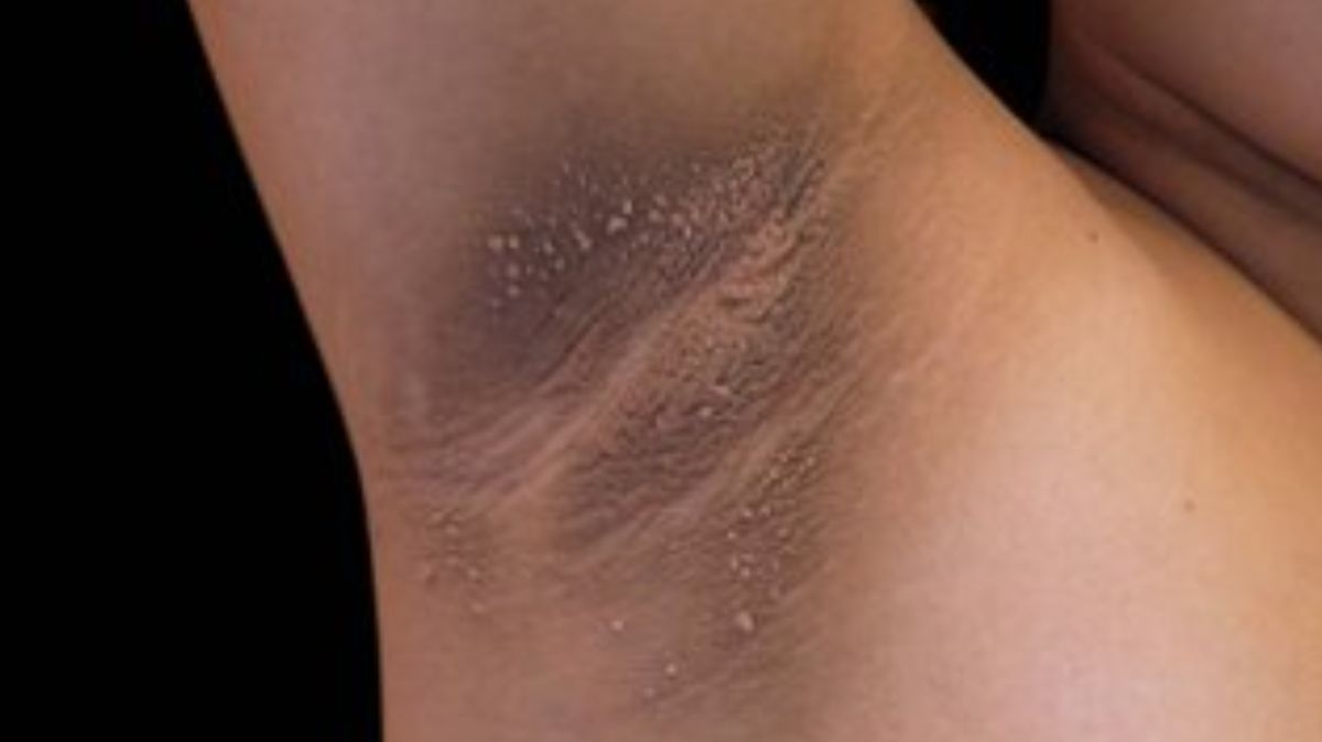 artical  - 2025-08-20T230520.005