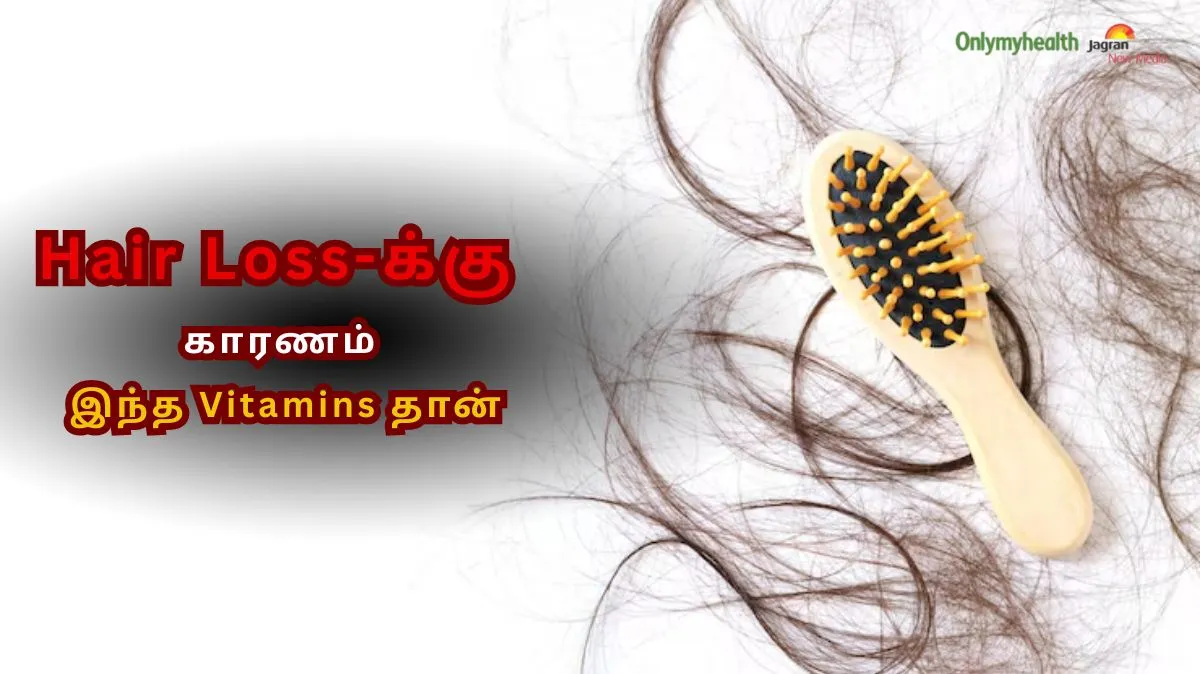 இந்த வைட்டமின்ஸ் இல்லனா முடி வளர்ச்சி நின்றுடும்!