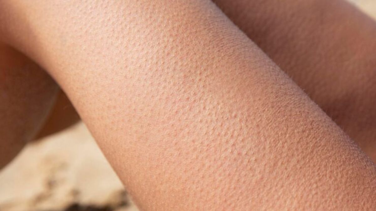 artical  - 2025-08-22T185121.720