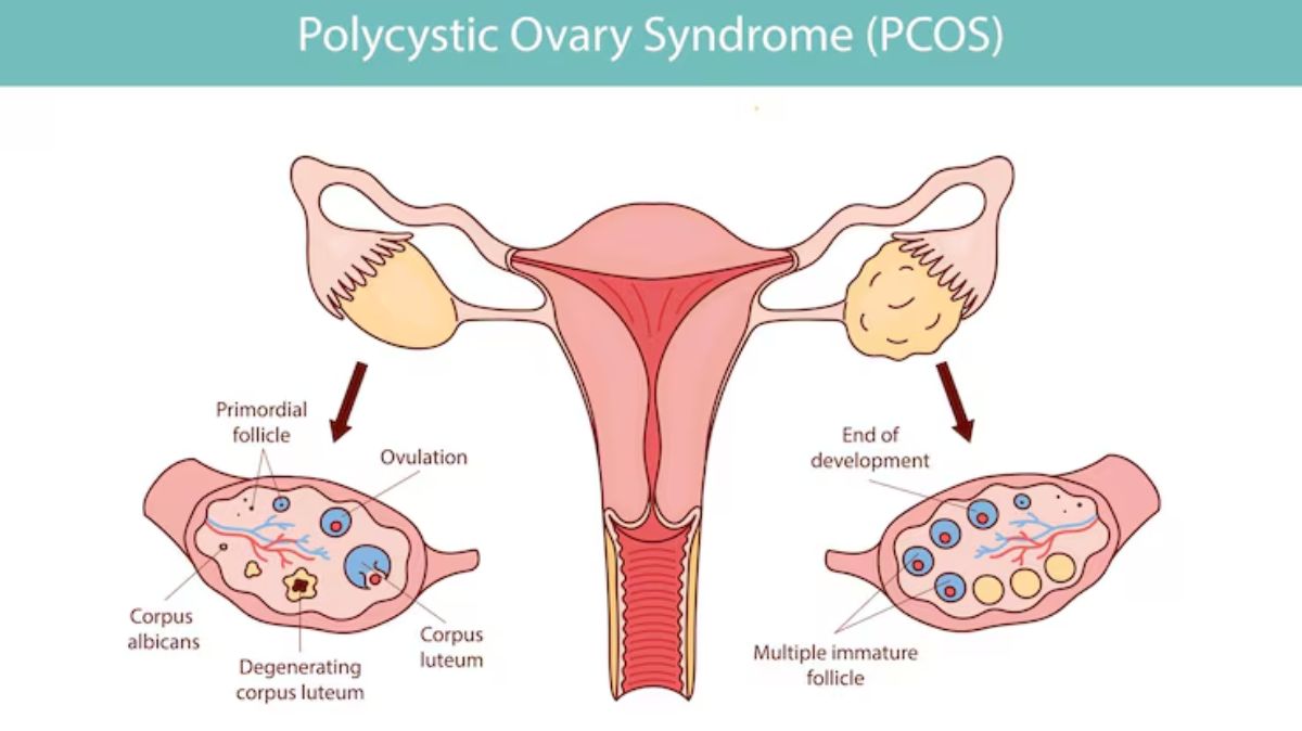 artical  - 2025-08-25T124528.703