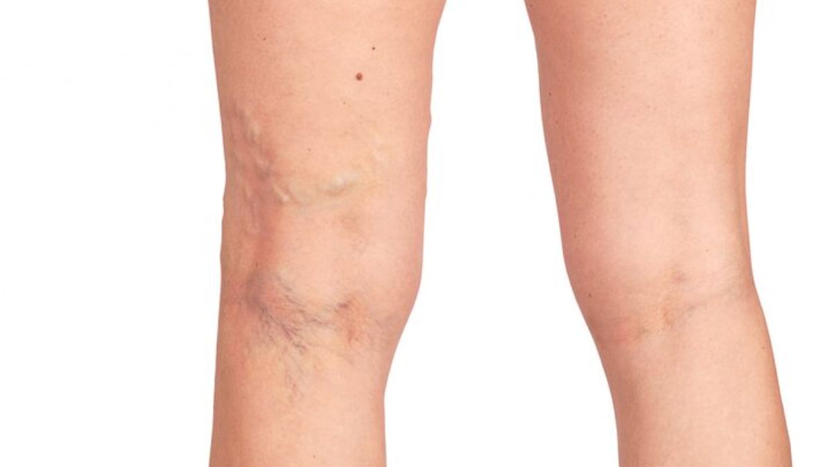 artical  - 2025-10-08T123454.932