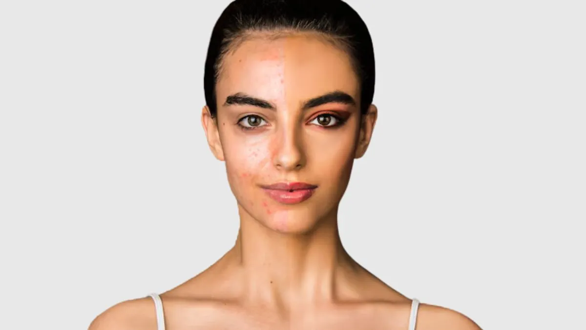 கரும்புள்ளிகள் மட்டுமல்ல.. பிக்மென்டேஷனையும் விரட்டி அடிக்க இந்த வீட்டு வைத்தியங்களை ட்ரை பண்ணுங்க! மருத்துவர் ஹன்சாஜி விளக்கம்