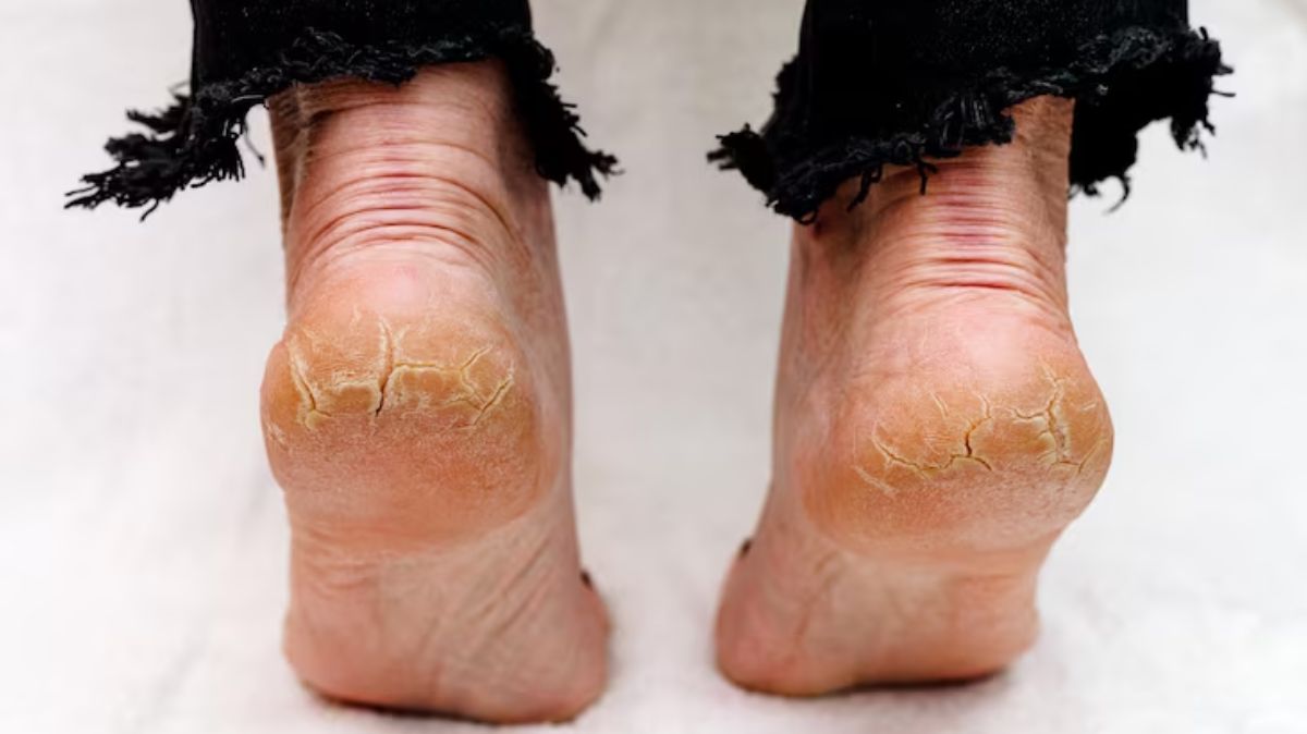 artical - 2025-11-06T220122.642