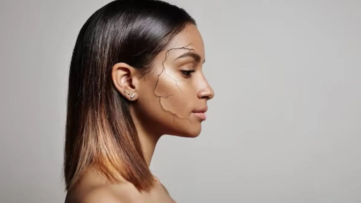 குளிர்காலத்தில் வறண்ட சருமம்? இதோ வீட்டிலேயே செய்யக்கூடிய 4 இயற்கை வைத்தியங்கள்!