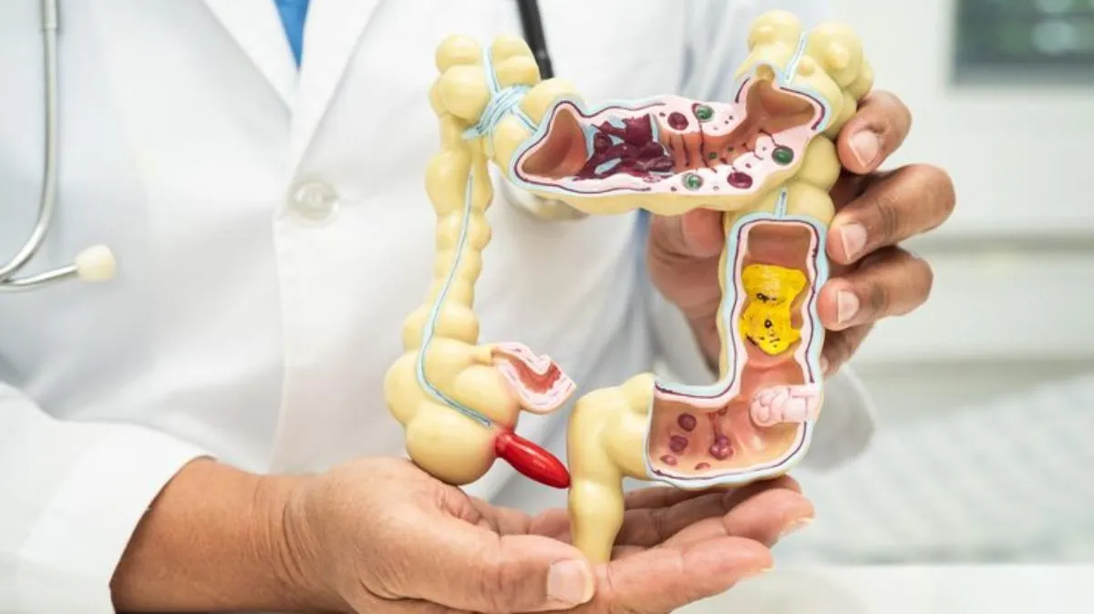 தக்காளி முதல் கிவி வரை... குடல் புற்றுநோயைத் தடுக்கும் 8 அற்புத உணவுகள் – டாக்டர் ஜோசப் சல்ஹாப் பரிந்துரை!